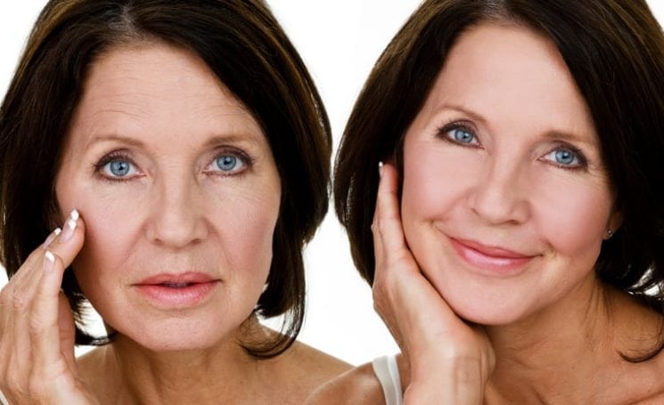 Expatriate retirees have to be careful when considering cosmetic surgery in Costa Rica